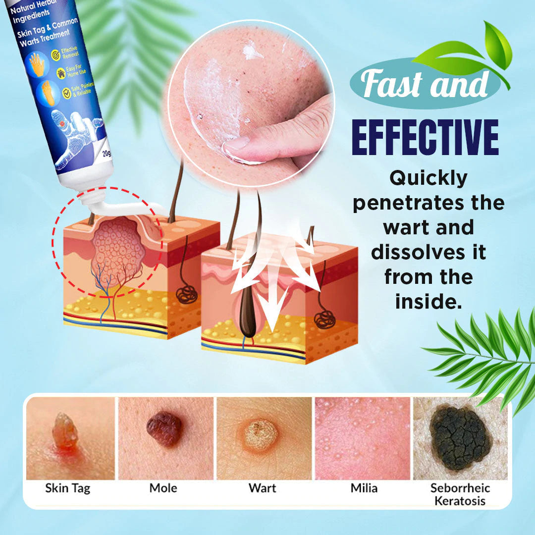 Wart Removal Ointment Plus【product fidelity！】