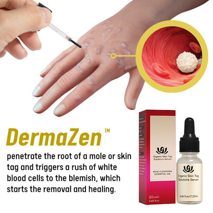 DermaZen™ Skin Tag Remover