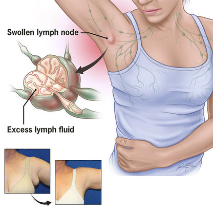 Lymphatic Drainage Therapeutic Magnetic Ring